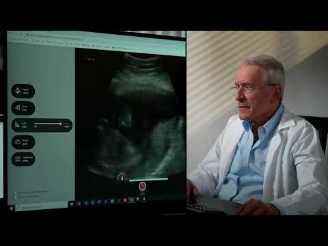 pulsenmore-is-expanding-the-application-of-its-home-ultrasound-solution-for-pregnant-women:-a-clinical-trial-with-michigan-medicine-will-focus-on-the-remote-assessment-of-the-fetal-biophysical-profile